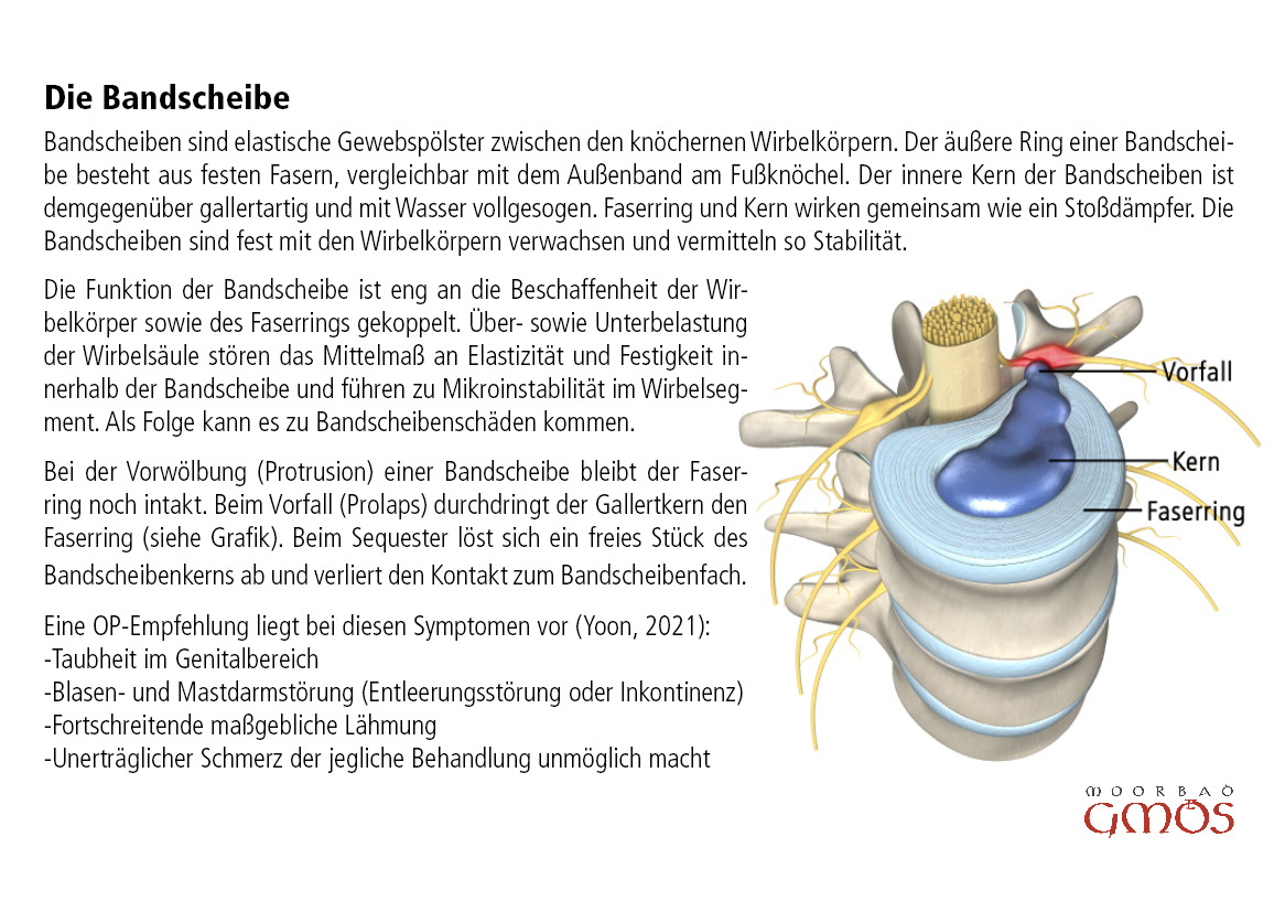 postkarte bandscheibe 1