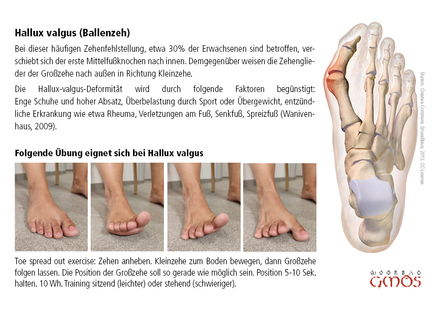 postkarte hallux valgus