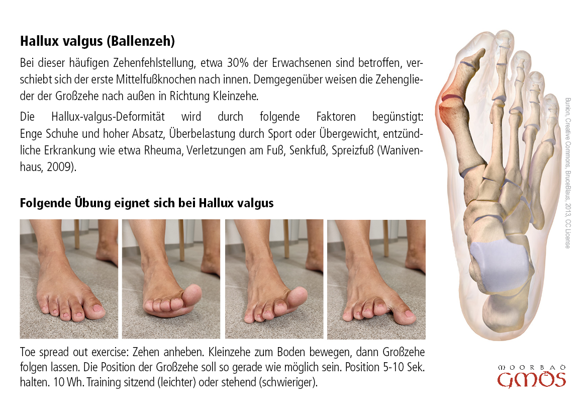 postkarte hallux valgus 1